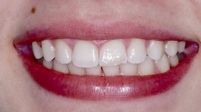 X06650-before-lighter